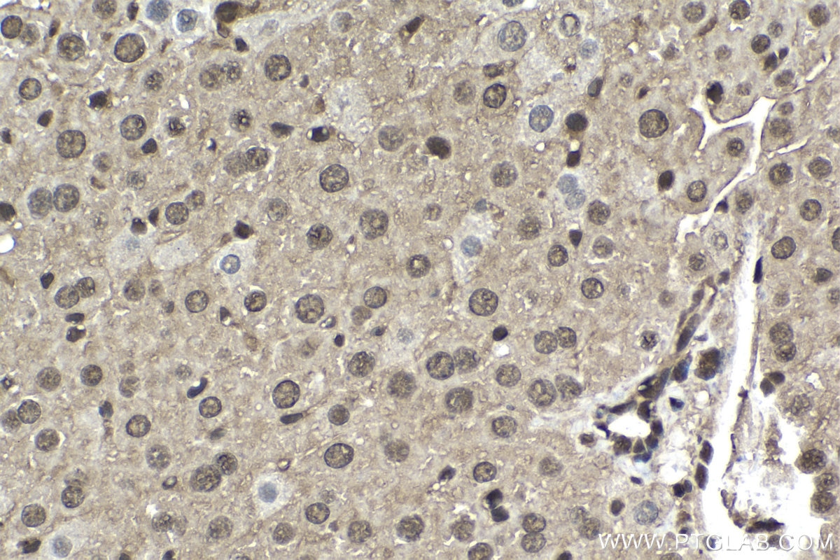 Immunohistochemical analysis of paraffin-embedded mouse liver tissue slide using KHC1519 (UBC IHC Kit).