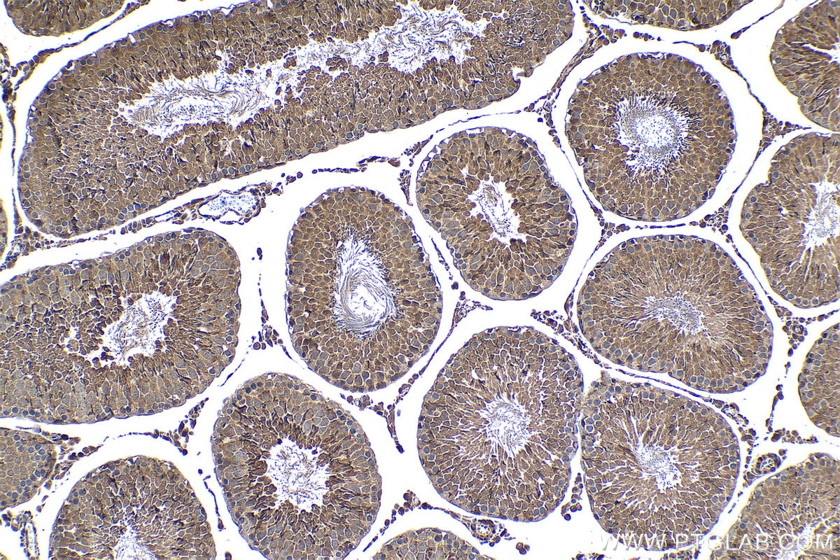 Immunohistochemical analysis of paraffin-embedded rat testis tissue slide using KHC1296 (UBE2L3 IHC Kit).