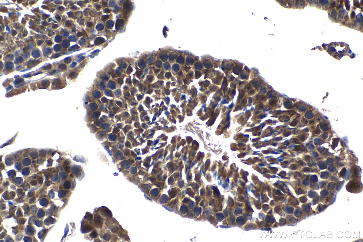 Immunohistochemical analysis of paraffin-embedded mouse testis tissue slide using KHC1296 (UBE2L3 IHC Kit).