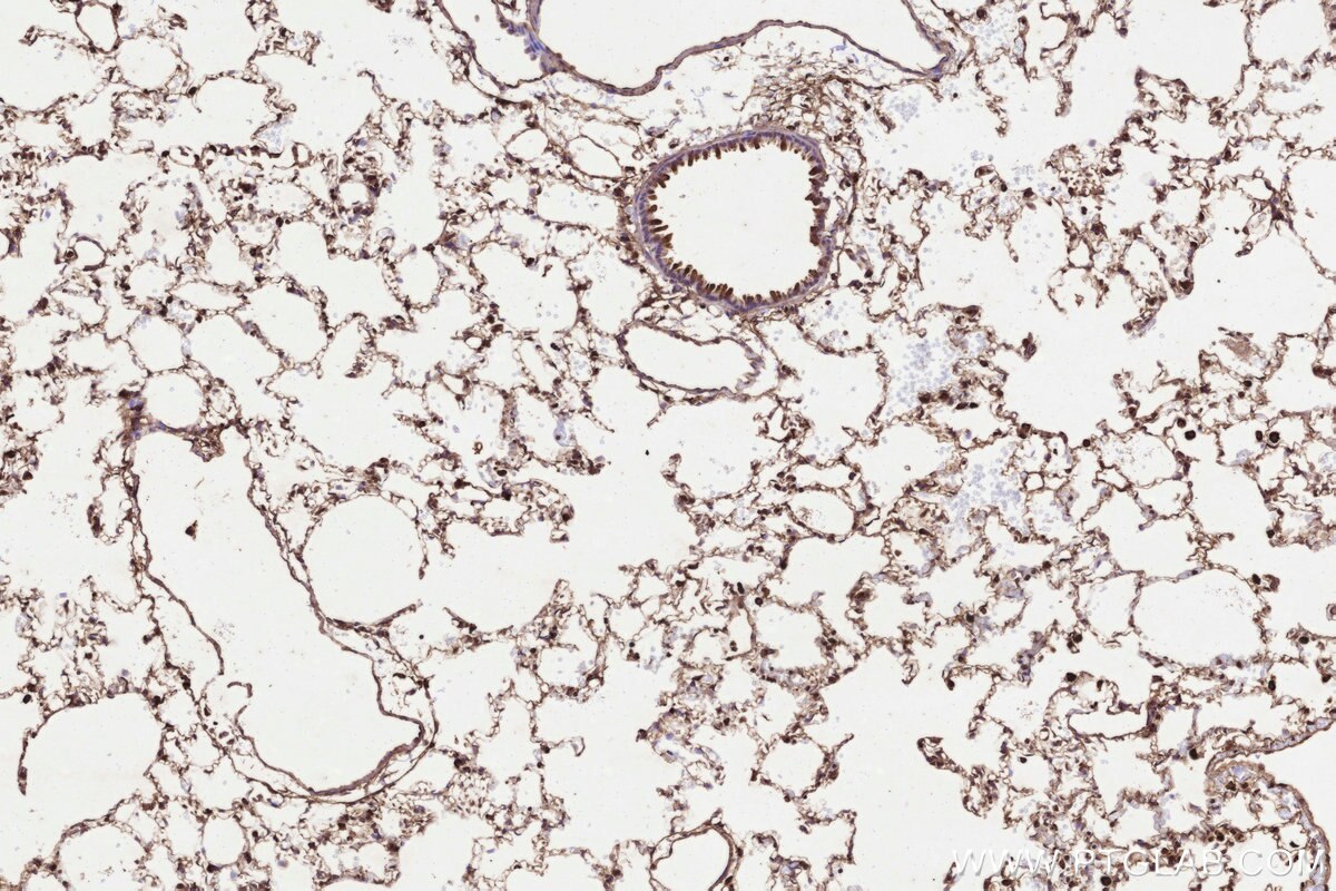 Immunohistochemical analysis of paraffin-embedded rat lung tissue slide using KHC3235 (UBE2M/UBC12 IHC Kit). Immunohistochemical analysis of paraffin-embedded rat lung tissue slide using KHC3235 (UBE2M/UBC12 IHC Kit).