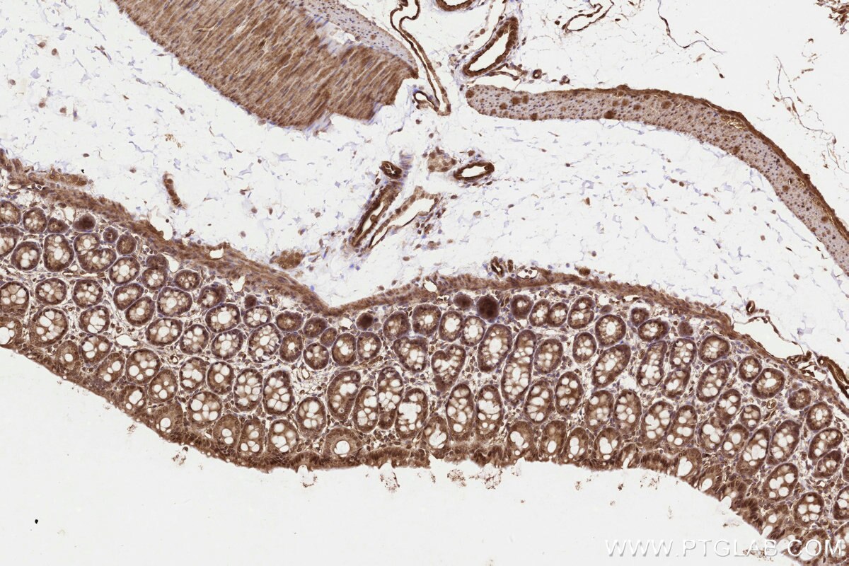 Immunohistochemical analysis of paraffin-embedded rat colon tissue slide using KHC3235 (UBE2M/UBC12 IHC Kit). Immunohistochemical analysis of paraffin-embedded rat colon tissue slide using KHC3235 (UBE2M/UBC12 IHC Kit).