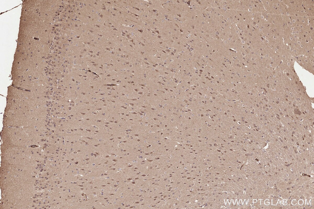 Immunohistochemical analysis of paraffin-embedded rat brain tissue slide using KHC3235 (UBE2M/UBC12 IHC Kit). Immunohistochemical analysis of paraffin-embedded rat brain tissue slide using KHC3235 (UBE2M/UBC12 IHC Kit).