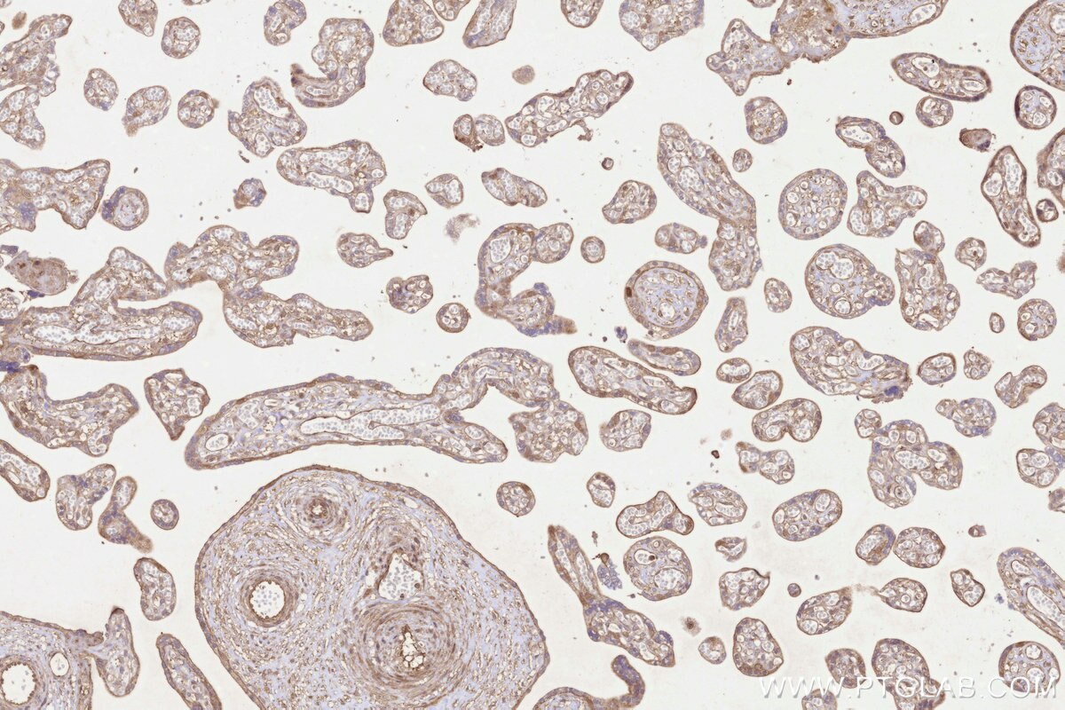 Immunohistochemical analysis of paraffin-embedded human placenta tissue slide using KHC3235 (UBE2M/UBC12 IHC Kit). Immunohistochemical analysis of paraffin-embedded human placenta tissue slide using KHC3235 (UBE2M/UBC12 IHC Kit).