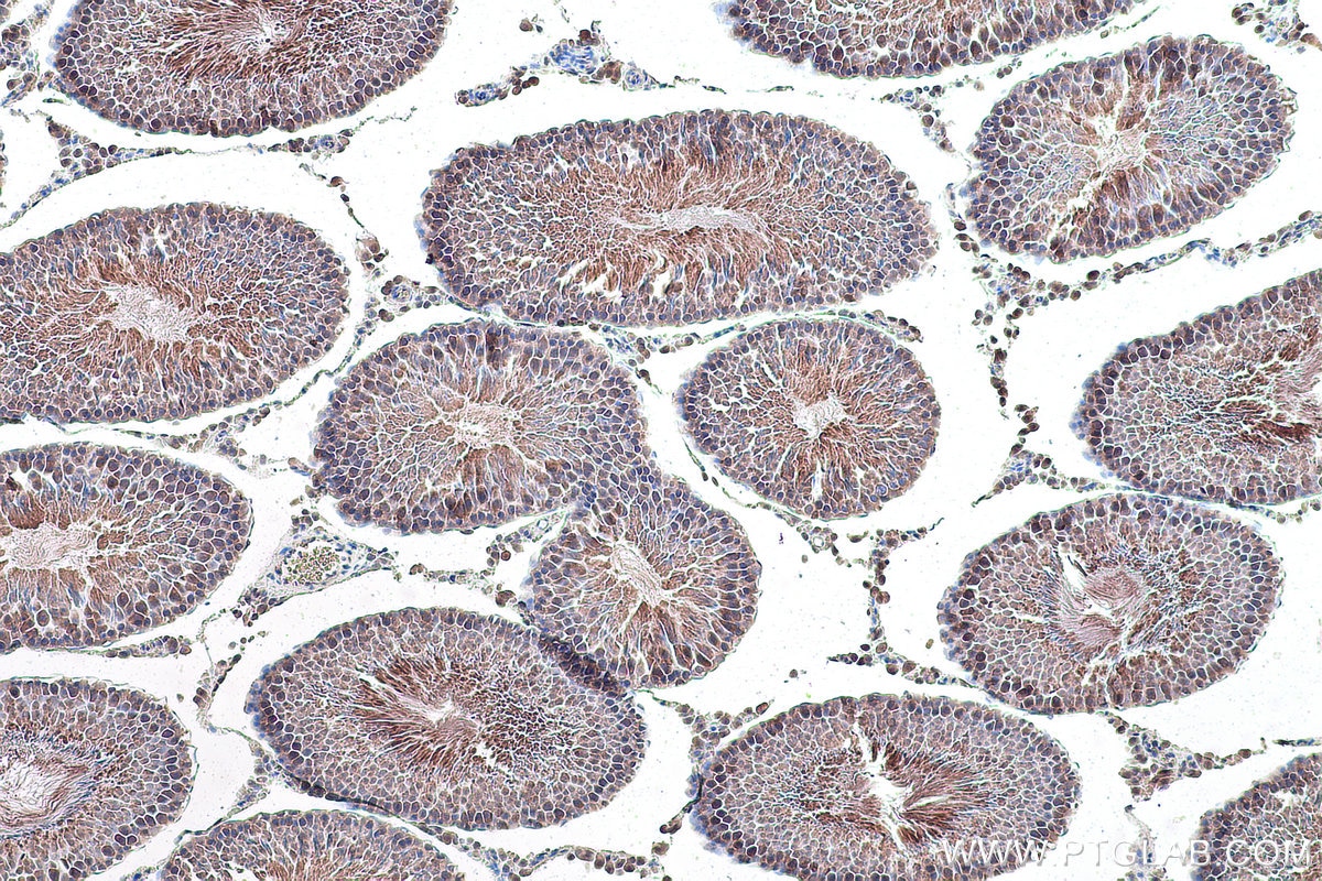 Immunohistochemical analysis of paraffin-embedded rat testis tissue slide using KHC0872 (UBE2N IHC Kit).