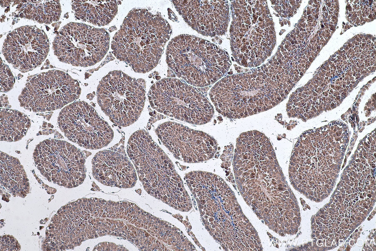 Immunohistochemical analysis of paraffin-embedded mouse testis tissue slide using KHC0872 (UBE2N IHC Kit).