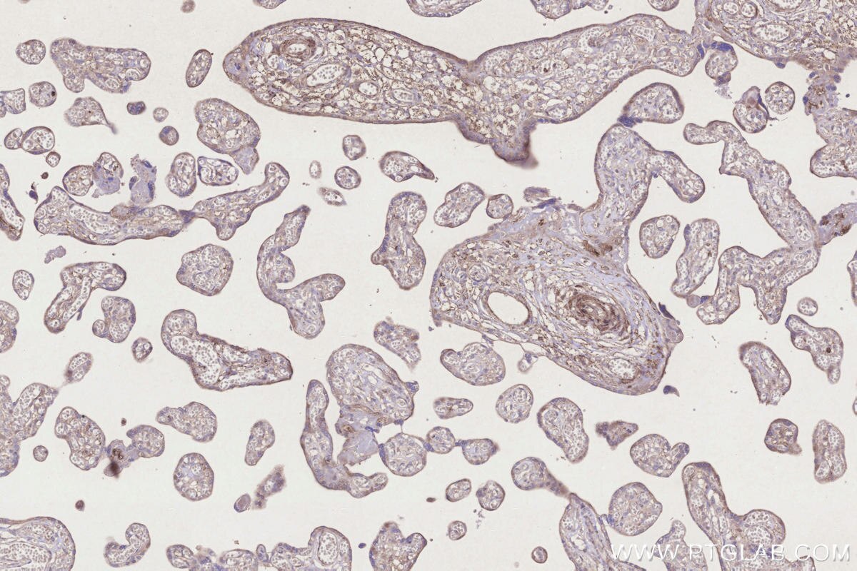Immunohistochemical analysis of paraffin-embedded human placenta tissue slide using KHC3276 (UBE2R2 IHC Kit).