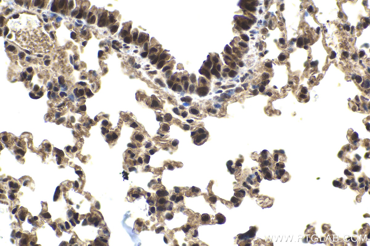 Immunohistochemical analysis of paraffin-embedded mouse lung tissue slide using KHC1602 (UBE3A IHC Kit).