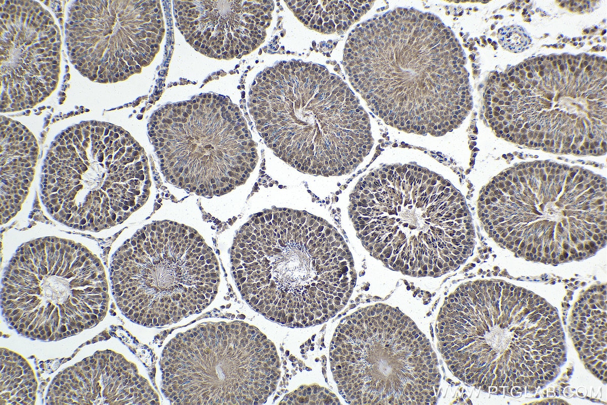Immunohistochemical analysis of paraffin-embedded rat testis tissue slide using KHC1602 (UBE3A IHC Kit).
