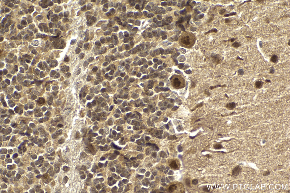 Immunohistochemical analysis of paraffin-embedded mouse cerebellum tissue slide using KHC2134 (UBE4B IHC Kit).