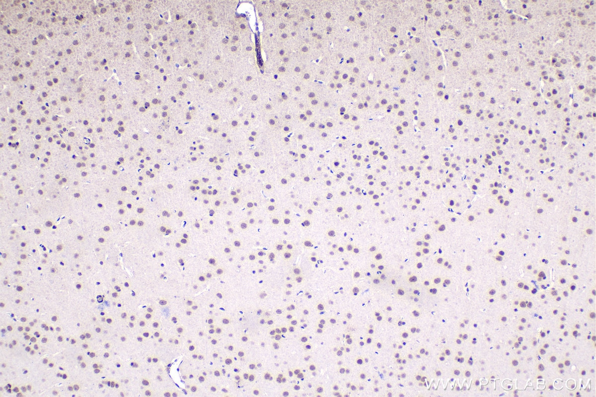 Immunohistochemical analysis of paraffin-embedded mouse brain tissue slide using KHC1490 (UBR5 IHC Kit).