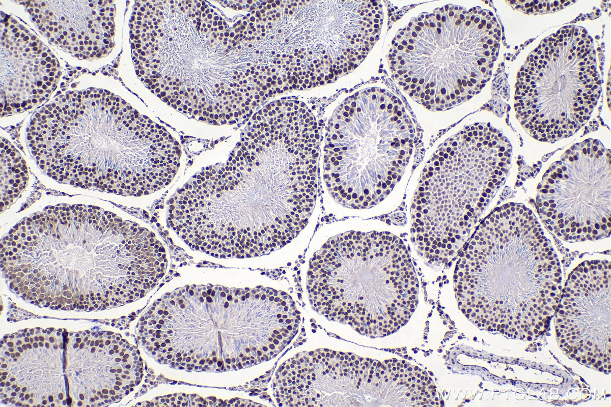 Immunohistochemical analysis of paraffin-embedded rat testis tissue slide using KHC1490 (UBR5 IHC Kit).