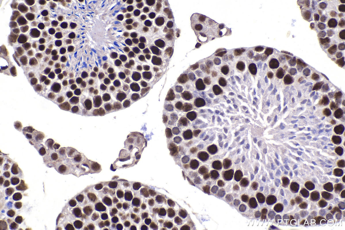 Immunohistochemical analysis of paraffin-embedded mouse testis tissue slide using KHC1490 (UBR5 IHC Kit).