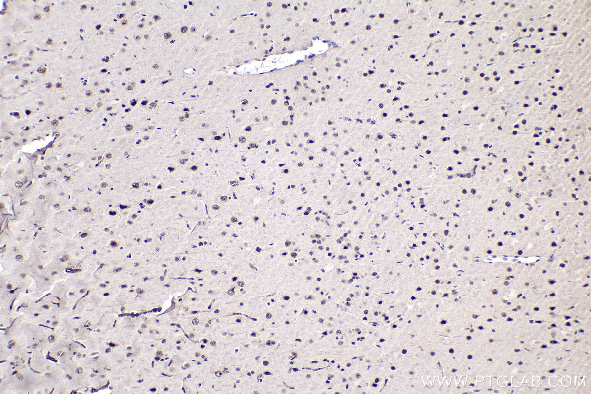 Immunohistochemical analysis of paraffin-embedded rat brain tissue slide using KHC1490 (UBR5 IHC Kit).