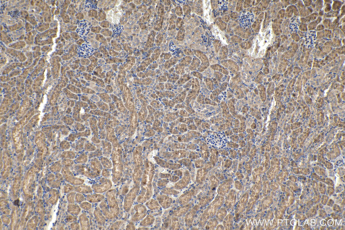 Immunohistochemical analysis of paraffin-embedded mouse kidney tissue slide using KHC1189 (UBTD1 IHC Kit).