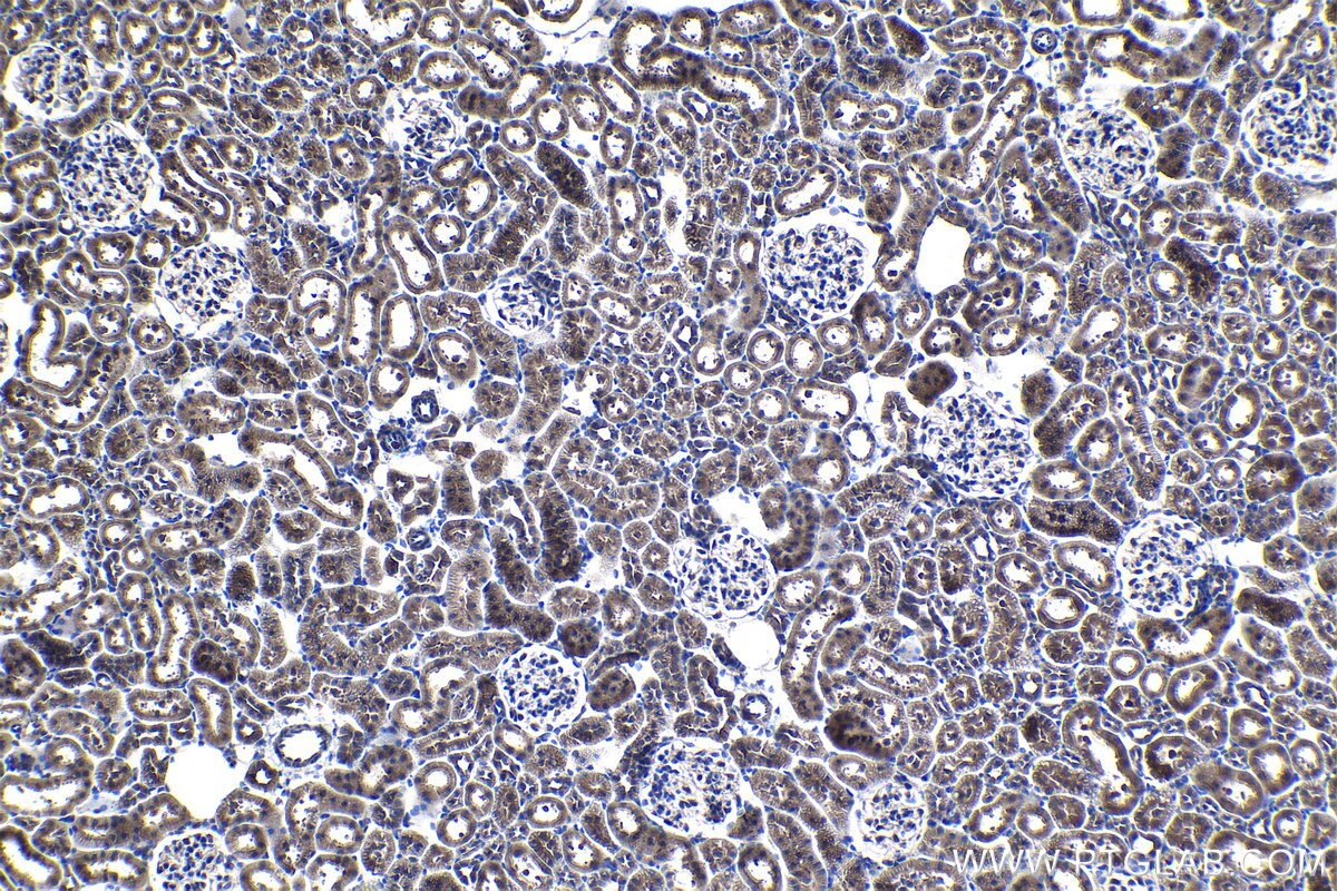 Immunohistochemical analysis of paraffin-embedded rat kidney tissue slide using KHC1189 (UBTD1 IHC Kit).