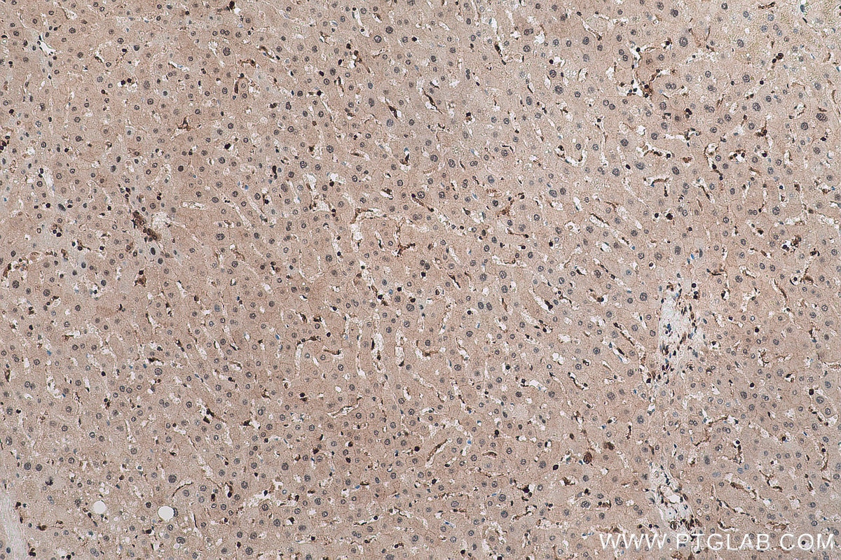 Immunohistochemical analysis of paraffin-embedded human liver tissue slide using KHC1006 (UBXN1 IHC Kit).