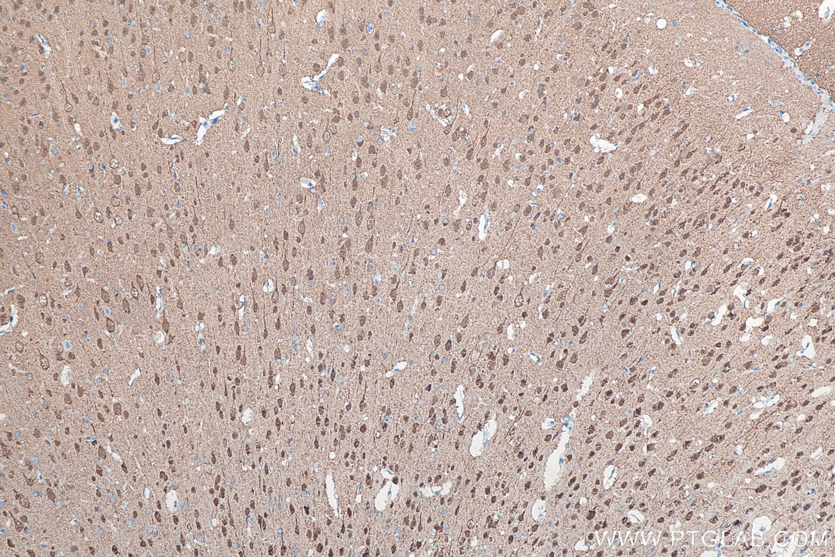 Immunohistochemical analysis of paraffin-embedded rat brain tissue slide using KHC0054 (UCHL1 IHC Kit).