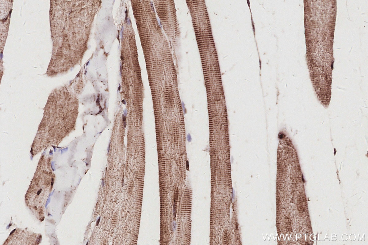 Immunohistochemical analysis of paraffin-embedded mouse skeletal muscle tissue slide using KHC3078 (UCHL5 IHC Kit). Immunohistochemical analysis of paraffin-embedded mouse skeletal muscle tissue slide using KHC3078 (UCHL5 IHC Kit).
