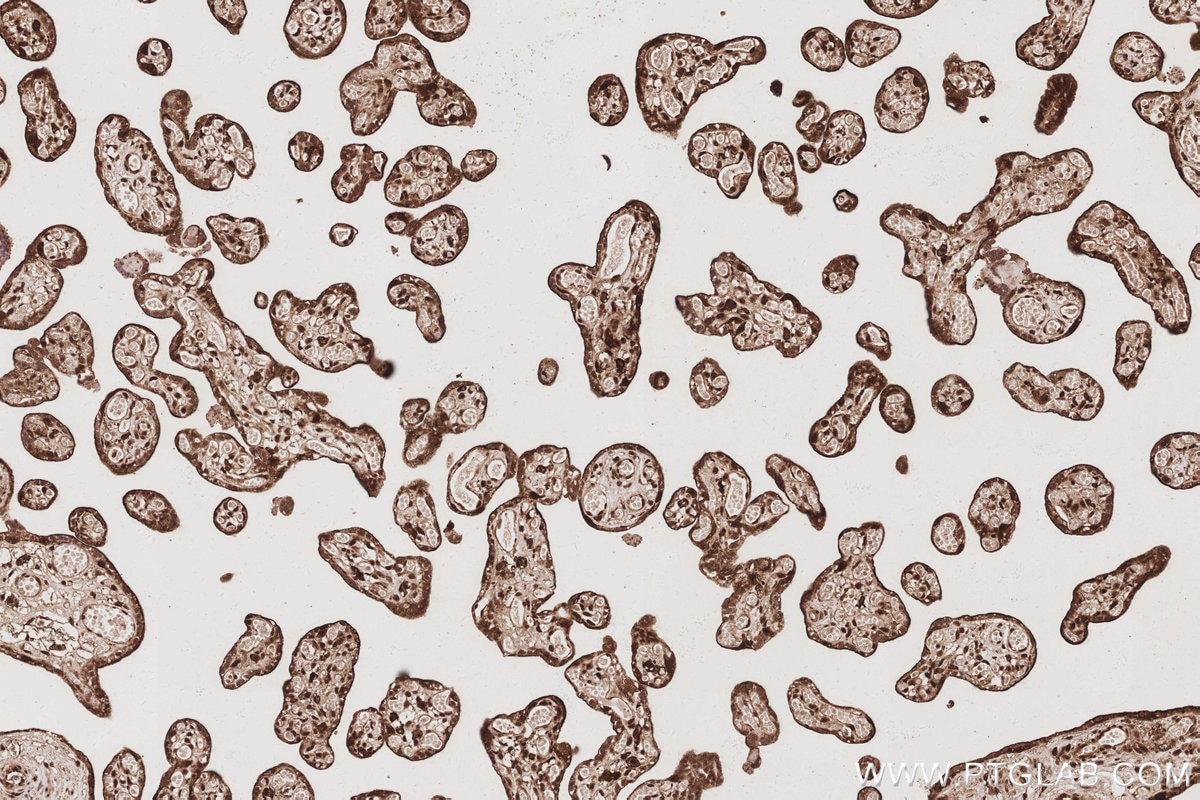 Immunohistochemical analysis of paraffin-embedded human placenta tissue slide using KHC3078 (UCHL5 IHC Kit). Immunohistochemical analysis of paraffin-embedded human placenta tissue slide using KHC3078 (UCHL5 IHC Kit).