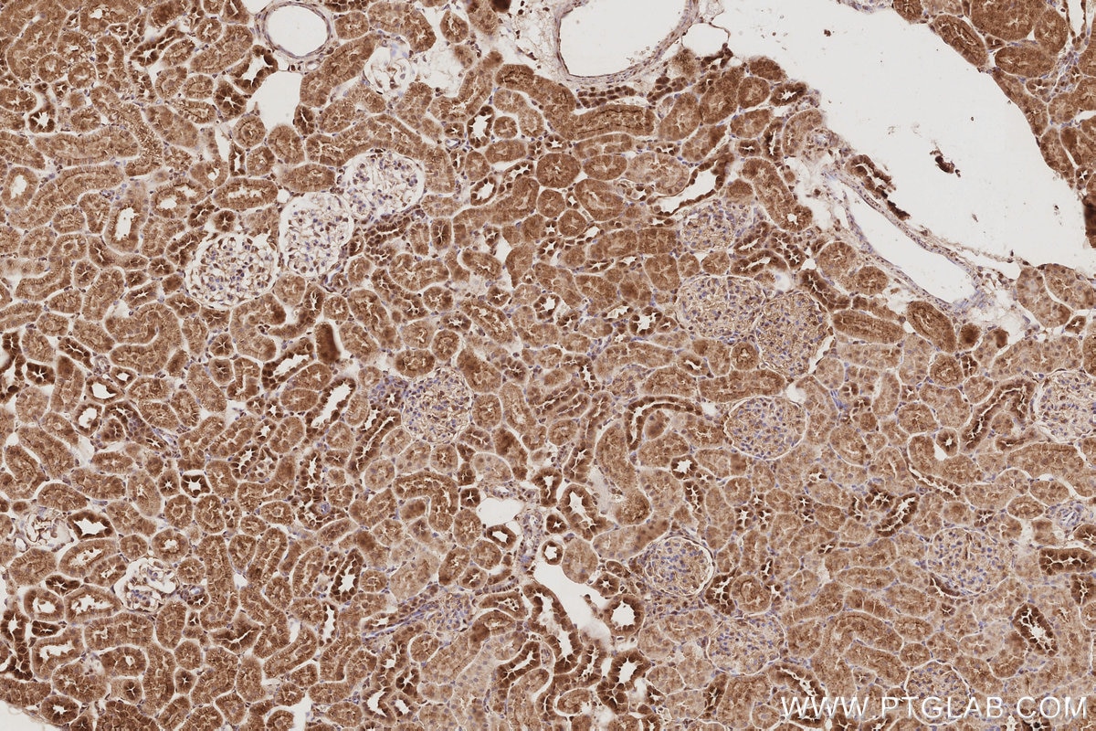 Immunohistochemical analysis of paraffin-embedded rat kidney tissue slide using KHC3078 (UCHL5 IHC Kit). Immunohistochemical analysis of paraffin-embedded rat kidney tissue slide using KHC3078 (UCHL5 IHC Kit).