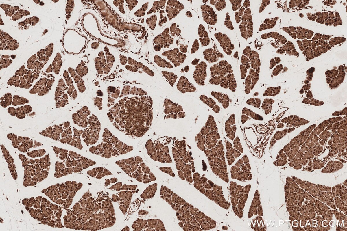 Immunohistochemical analysis of paraffin-embedded rat pancreas tissue slide using KHC3078 (UCHL5 IHC Kit). Immunohistochemical analysis of paraffin-embedded rat pancreas tissue slide using KHC3078 (UCHL5 IHC Kit).