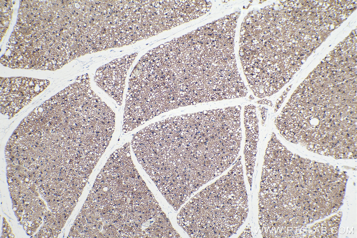 Immunohistochemical analysis of paraffin-embedded mouse brown adipose tissue slide using KHC0247 (UCP2 IHC Kit).