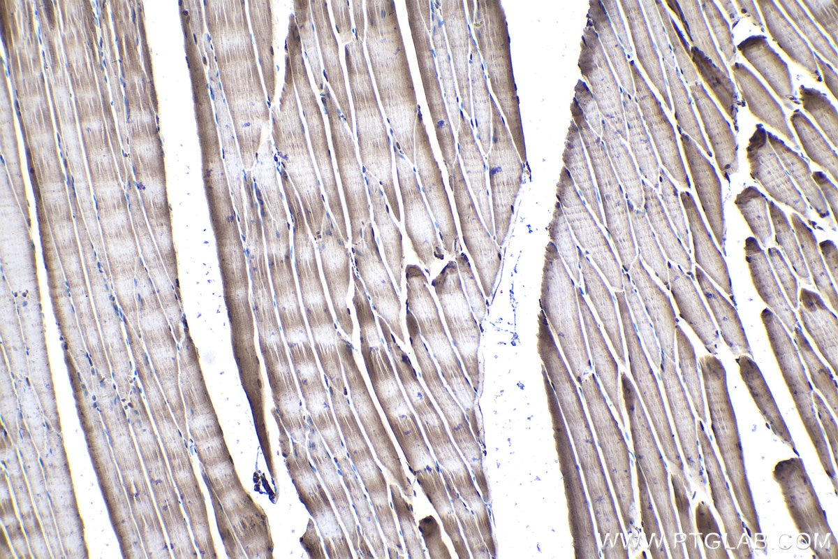 Immunohistochemical analysis of paraffin-embedded rat skeletal muscle tissue slide using KHC1037 (UFD1 IHC Kit).