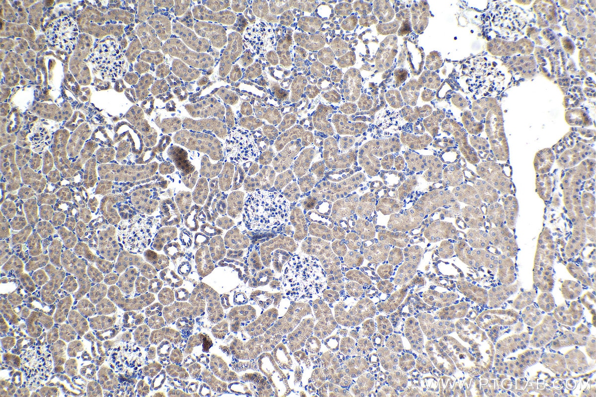 Immunohistochemical analysis of paraffin-embedded rat kidney tissue slide using KHC1486 (UFL1 IHC Kit).