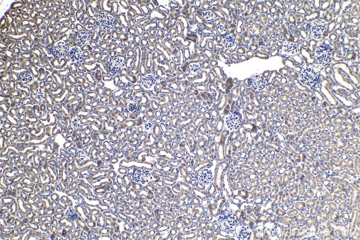 Immunohistochemical analysis of paraffin-embedded mouse kidney tissue slide using KHC1486 (UFL1 IHC Kit).