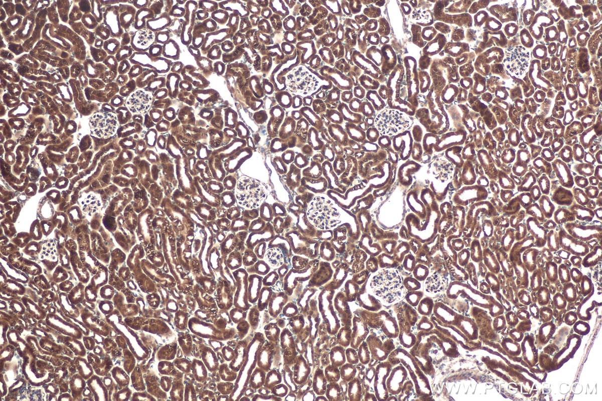 Immunohistochemical analysis of paraffin-embedded mouse kidney tissue slide using KHC0949 (UFM1 IHC Kit).