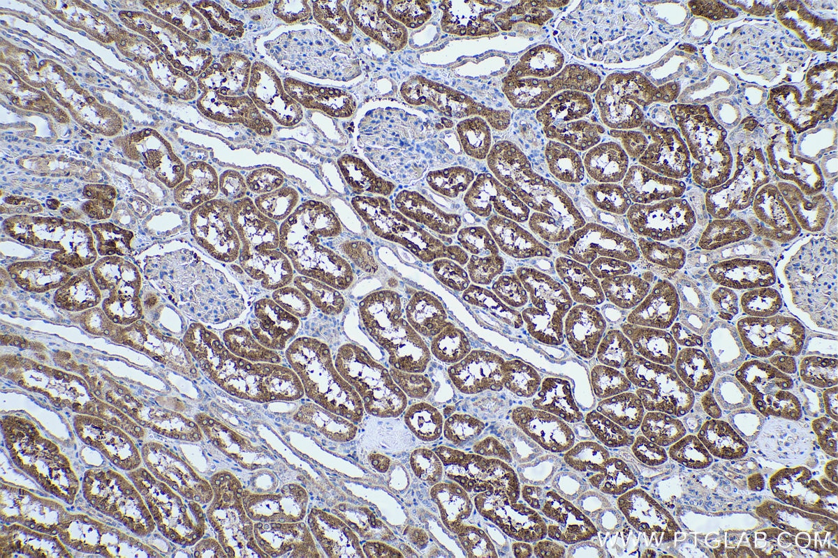 Immunohistochemical analysis of paraffin-embedded human kidney tissue slide using KHC0470 (UGT2B4 IHC Kit).