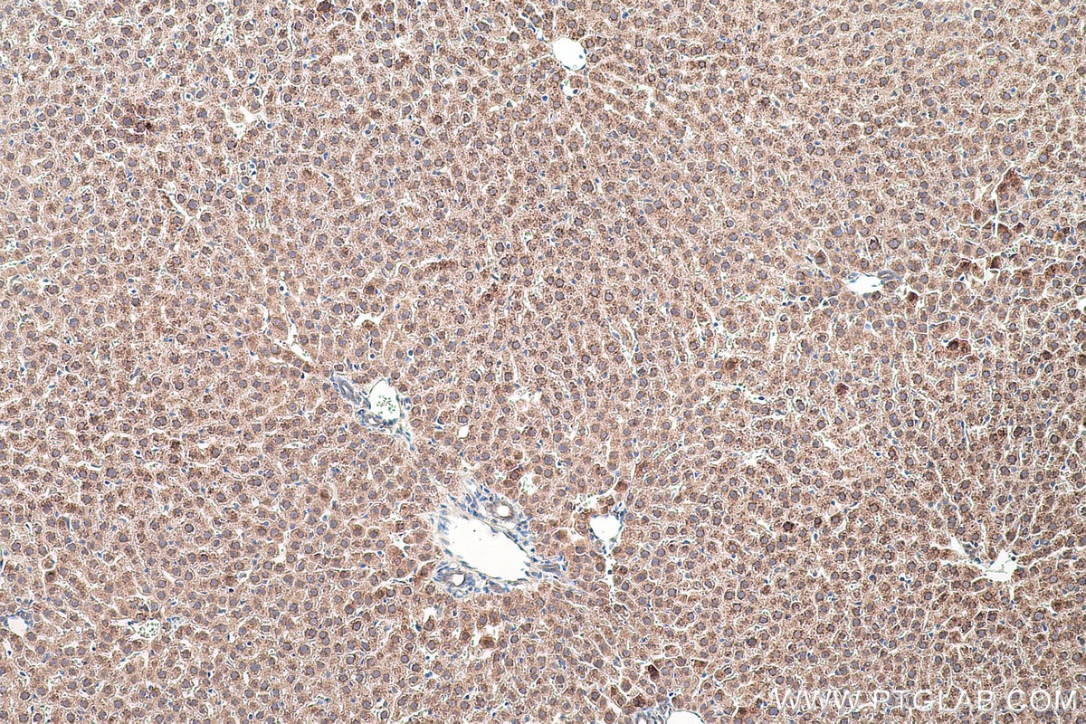 Immunohistochemical analysis of paraffin-embedded rat liver tissue slide using KHC0471 (UGT2B7 IHC Kit).