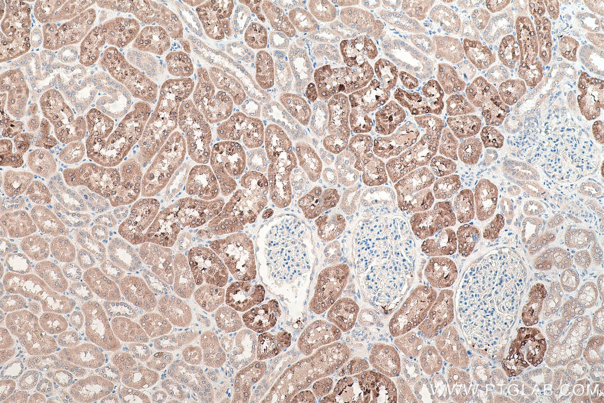 Immunohistochemical analysis of paraffin-embedded human kidney tissue slide using KHC0471 (UGT2B7 IHC Kit).