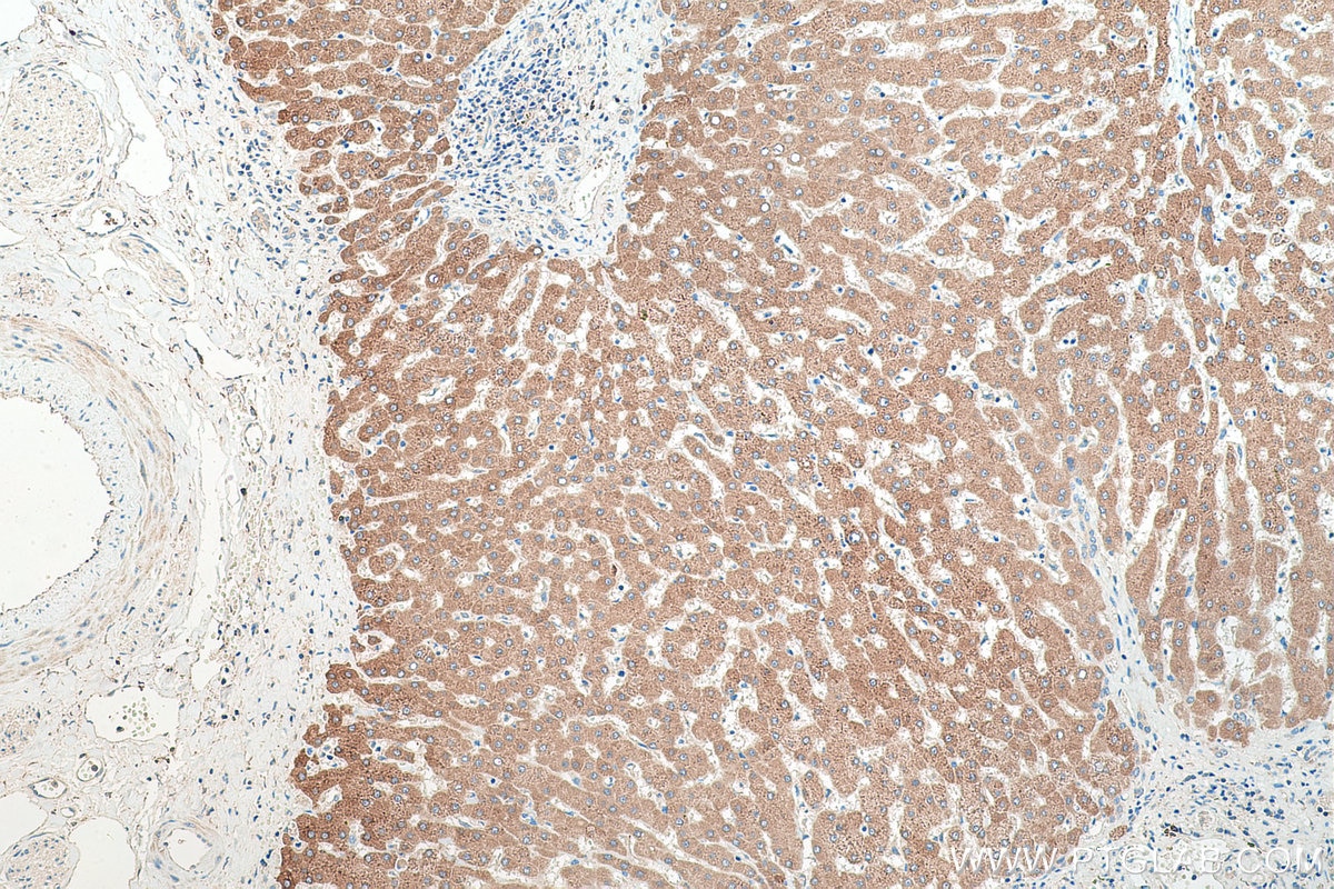Immunohistochemical analysis of paraffin-embedded human liver tissue slide using KHC0471 (UGT2B7 IHC Kit).