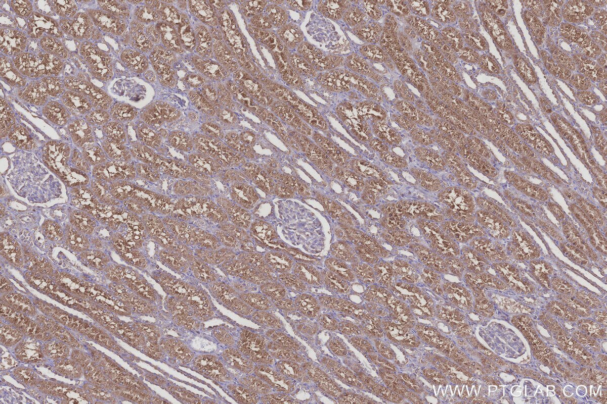 Immunohistochemical analysis of paraffin-embedded human kidney tissue slide using KHC3258 (UGT8 IHC Kit).