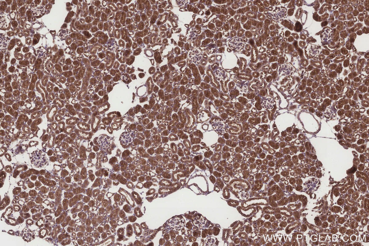 Immunohistochemical analysis of paraffin-embedded mouse kidney tissue slide using KHC3258 (UGT8 IHC Kit).
