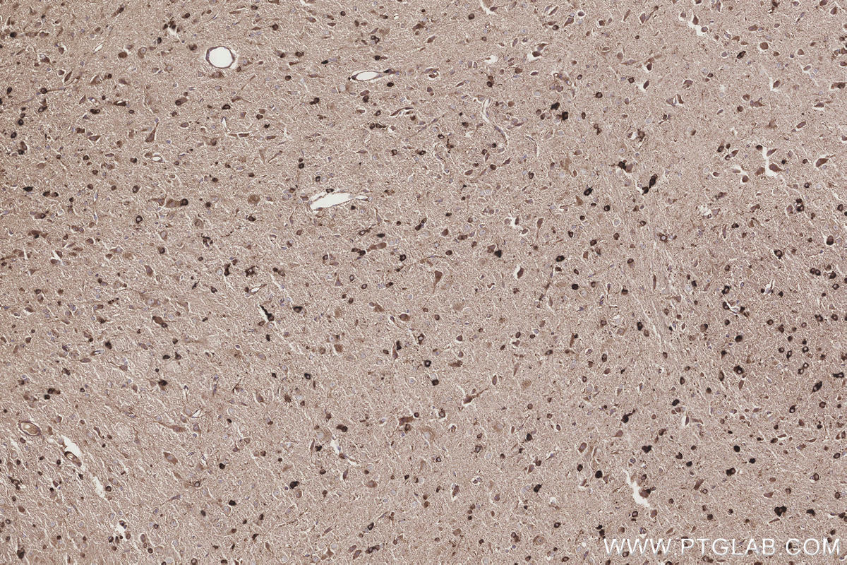 Immunohistochemical analysis of paraffin-embedded rat brain tissue slide using KHC3258 (UGT8 IHC Kit).