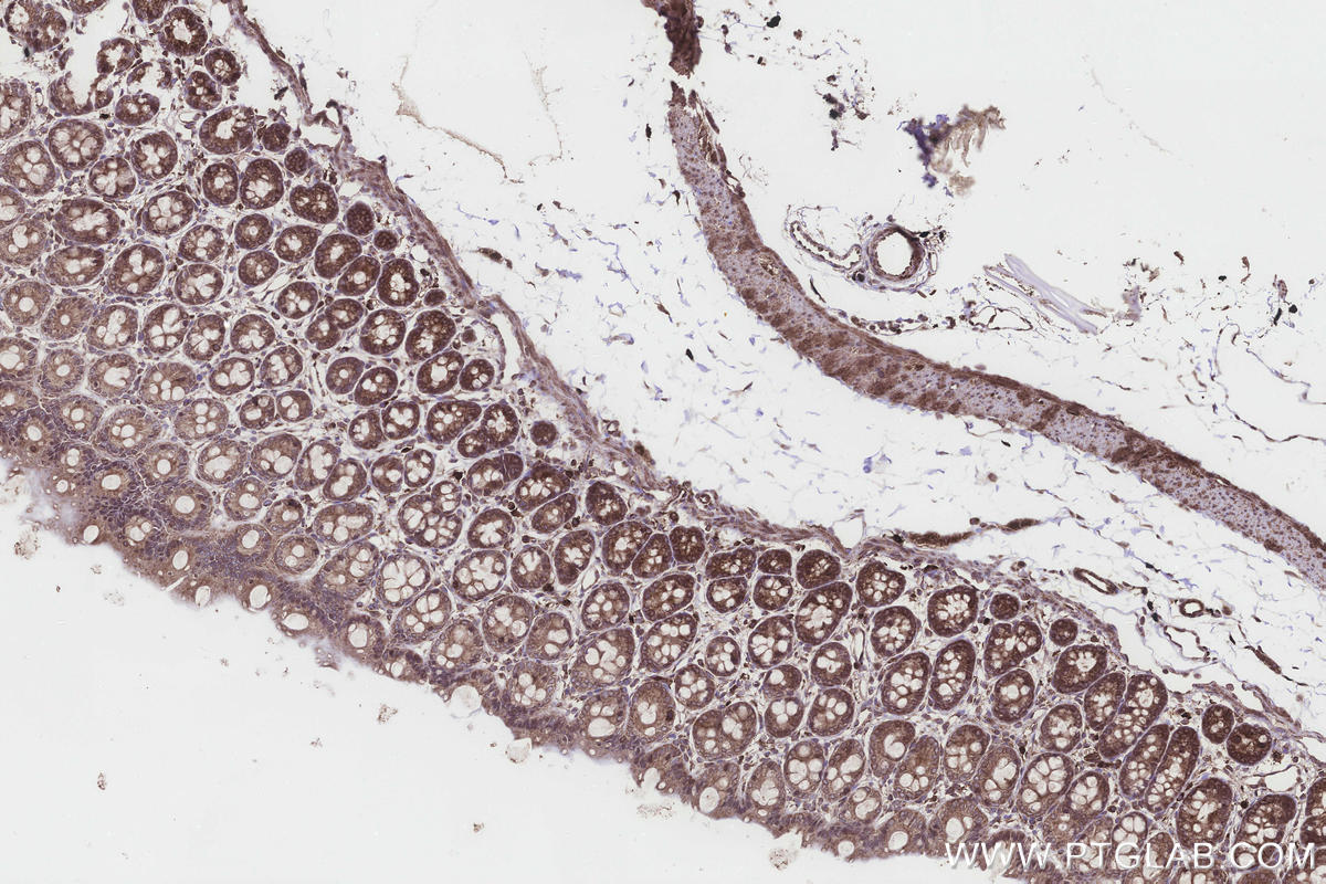 Immunohistochemical analysis of paraffin-embedded rat colon tissue slide using KHC3258 (UGT8 IHC Kit).