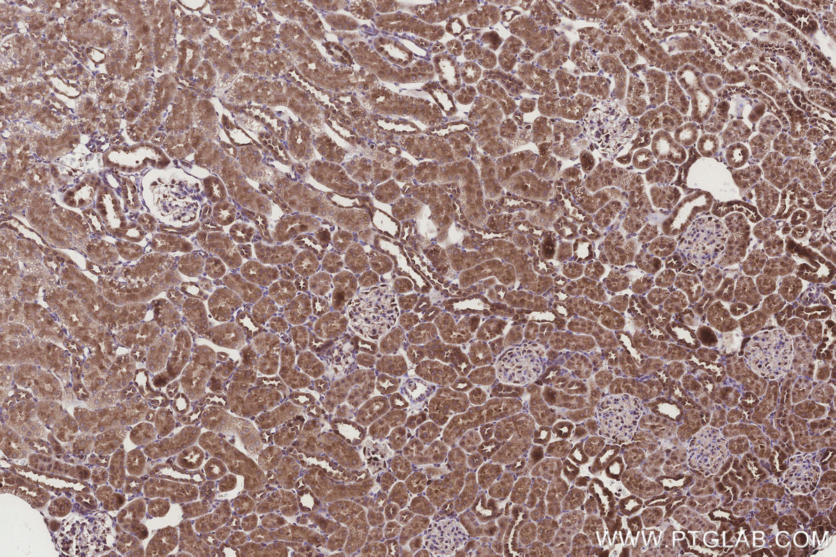 Immunohistochemical analysis of paraffin-embedded rat kidney tissue slide using KHC3258 (UGT8 IHC Kit).