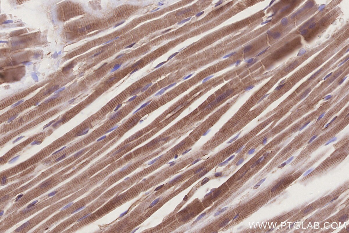 Immunohistochemical analysis of paraffin-embedded rat heart tissue slide using KHC3268 (UHRF1BP1 IHC Kit). Immunohistochemical analysis of paraffin-embedded rat heart tissue slide using KHC3268 (UHRF1BP1 IHC Kit).