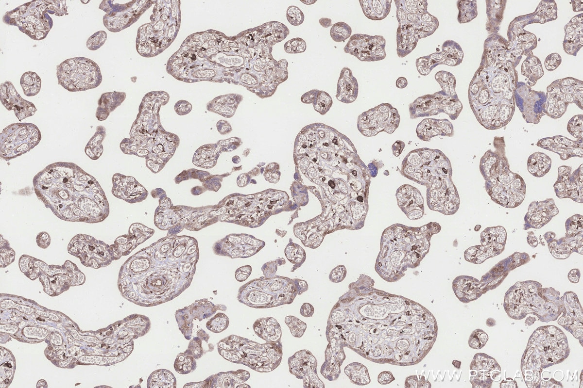 Immunohistochemical analysis of paraffin-embedded human placenta tissue slide using KHC3268 (UHRF1BP1 IHC Kit). Immunohistochemical analysis of paraffin-embedded human placenta tissue slide using KHC3268 (UHRF1BP1 IHC Kit).
