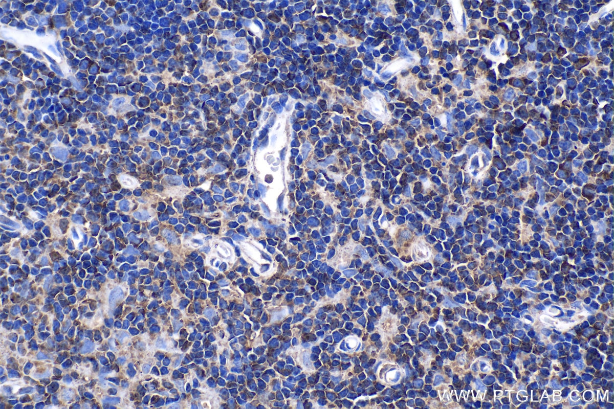 Immunohistochemical analysis of paraffin-embedded rat thymus tissue slide using KHC1158 (UNC13D IHC Kit).