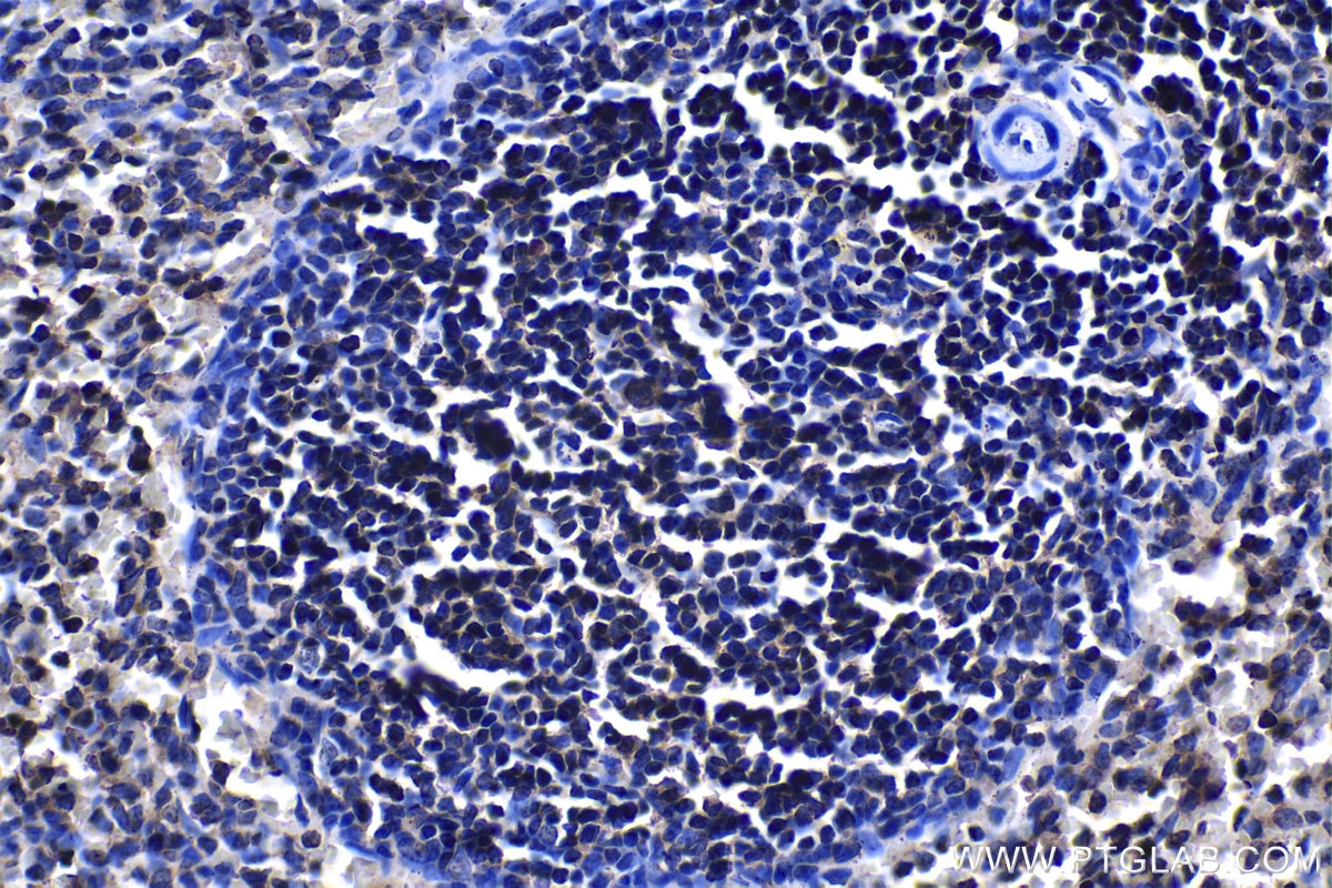 Immunohistochemical analysis of paraffin-embedded rat spleen tissue slide using KHC1158 (UNC13D IHC Kit).