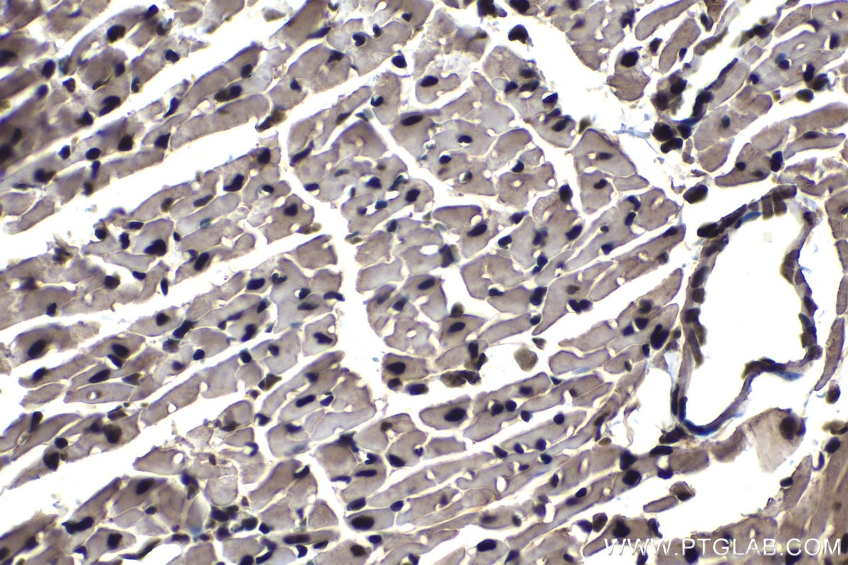Immunohistochemical analysis of paraffin-embedded mouse heart tissue slide using KHC1170 (UNG IHC Kit).