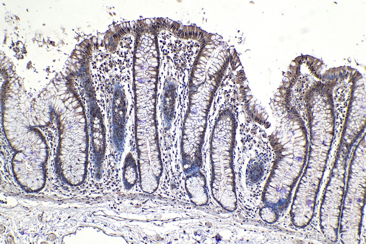 Immunohistochemical analysis of paraffin-embedded human colon tissue slide using KHC1170 (UNG IHC Kit).