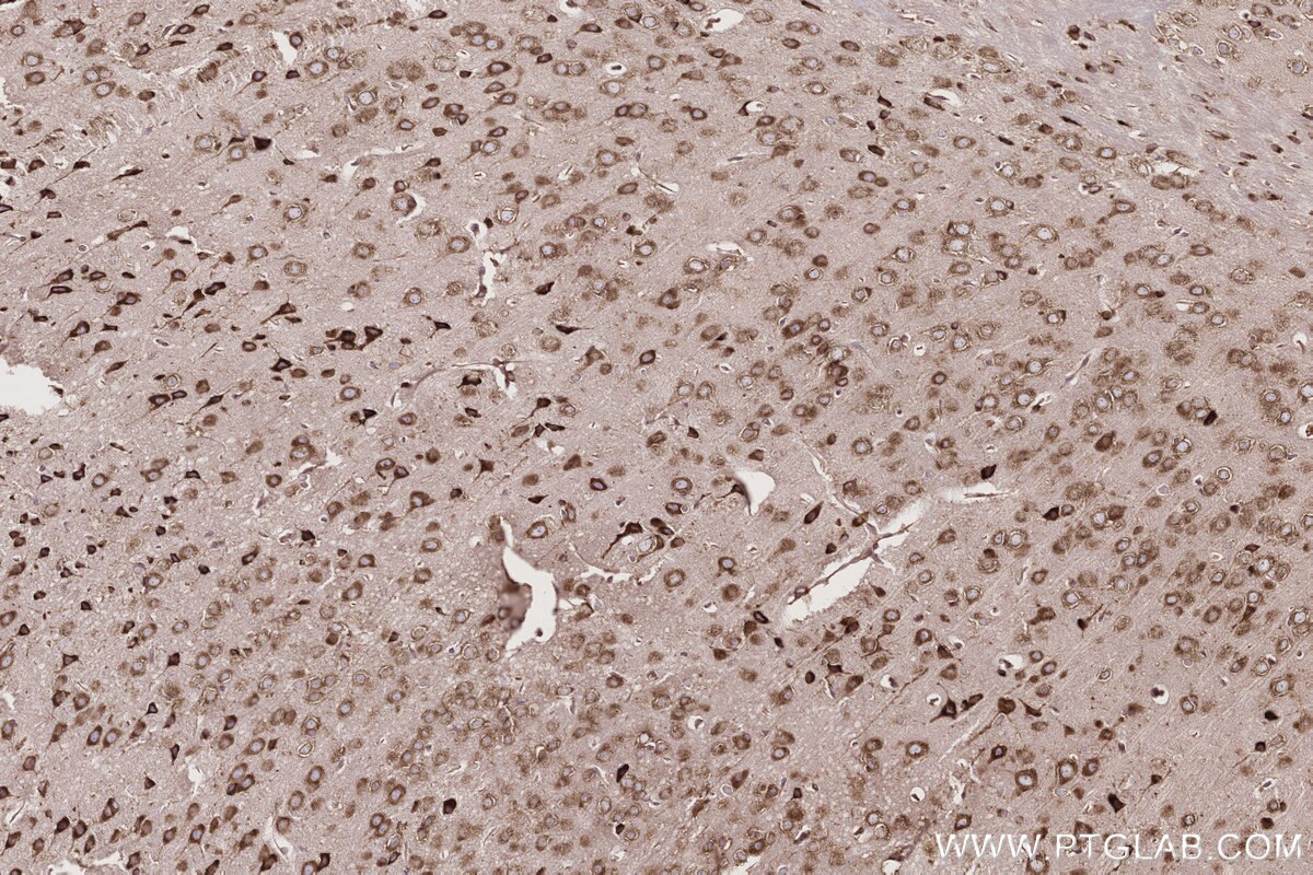Immunohistochemical analysis of paraffin-embedded mouse brain tissue slide using KHC2765 (UPF1 IHC Kit).