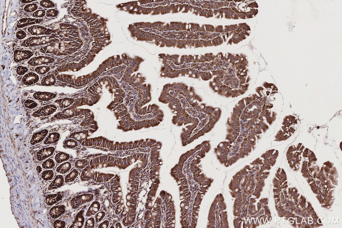 Immunohistochemical analysis of paraffin-embedded rat small intestine tissue slide using KHC2765 (UPF1 IHC Kit).