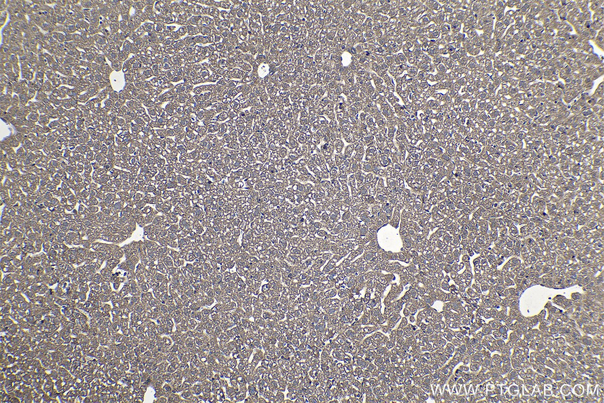 Immunohistochemical analysis of paraffin-embedded mouse liver tissue slide using KHC1400 (UQCRB IHC Kit).