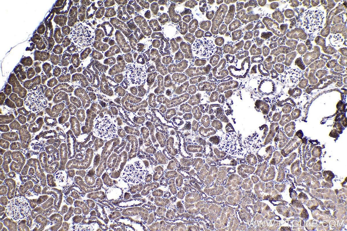 Immunohistochemical analysis of paraffin-embedded rat kidney tissue slide using KHC1400 (UQCRB IHC Kit).