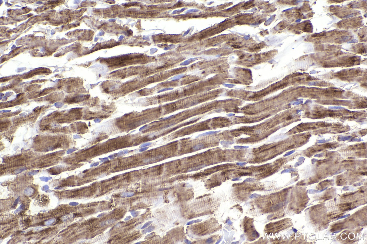 Immunohistochemical analysis of paraffin-embedded rat heart tissue slide using KHC2209 (UQCRC2 IHC Kit).
